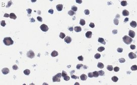 Anti-RSV Fusion Protein Antibody, clone 131-2A ZooMAb&#174; Mouse Monoclonal recombinant, expressed in HEK 293 cells
