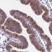 Anti-CDNF antibody produced in rabbit Prestige Antibodies&#174; Powered by Atlas Antibodies, affinity isolated antibody, buffered aqueous glycerol solution