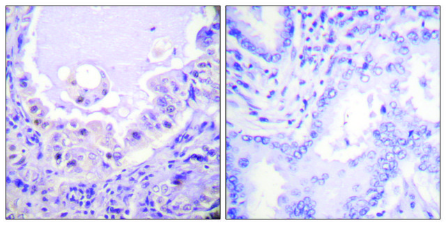 Anti-C-RAF, C-Terminal antibody produced in rabbit affinity isolated antibody