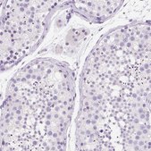 Anti-SSTR4 antibody produced in rabbit Prestige Antibodies&#174; Powered by Atlas Antibodies, affinity isolated antibody, buffered aqueous glycerol solution