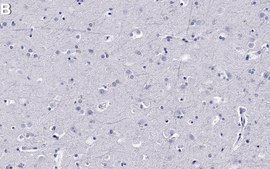 Anti-IFNAR2 Antibody, clone 1M16 ZooMAb&#174; Rabbit Monoclonal recombinant, expressed in HEK 293 cells
