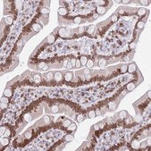Anti-LBR antibody produced in rabbit Prestige Antibodies&#174; Powered by Atlas Antibodies, affinity isolated antibody, buffered aqueous glycerol solution