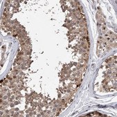Anti-RWDD2A antibody produced in rabbit Prestige Antibodies&#174; Powered by Atlas Antibodies, affinity isolated antibody, buffered aqueous glycerol solution, ab1