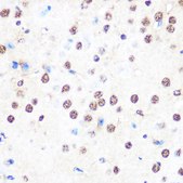 Anti-NONO/p54nrb antibody produced in rabbit