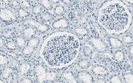 Anti-ILK Antibody, clone 1B22 ZooMAb&#174; Rabbit Monoclonal recombinant, expressed in HEK 293 cells