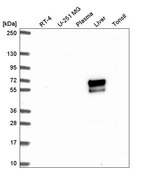 Anti-ACSM2A antibody produced in rabbit Prestige Antibodies&#174; Powered by Atlas Antibodies, affinity isolated antibody, buffered aqueous glycerol solution