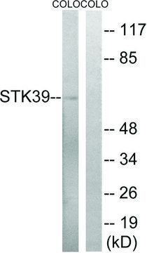 Anti-STK39 antibody produced in rabbit affinity isolated antibody