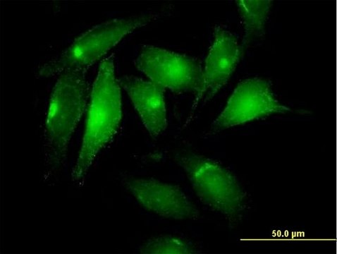 Anti-MSLN antibody produced in mouse purified immunoglobulin, buffered aqueous solution
