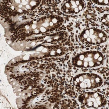 Anti-NCBP3 antibody produced in rabbit Prestige Antibodies&#174; Powered by Atlas Antibodies, affinity isolated antibody, buffered aqueous glycerol solution