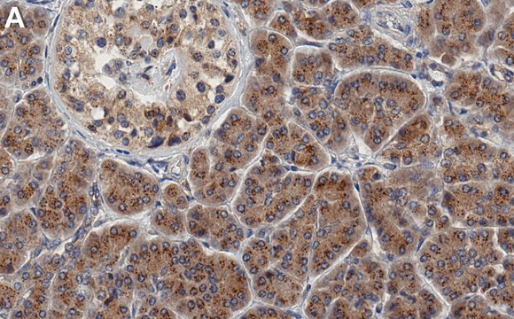 Anti-SLC12A4 Antibody, clone 1F16 ZooMAb&#174; Rabbit Monoclonal recombinant, expressed in HEK 293 cells