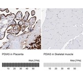 Anti-PDIA5 antibody produced in rabbit Prestige Antibodies&#174; Powered by Atlas Antibodies, affinity isolated antibody, buffered aqueous glycerol solution, ab3