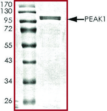 PEAK1, UNACTIVE recombinant