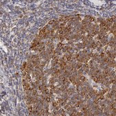 Anti-DDX3X antibody produced in rabbit Ab1, Prestige Antibodies&#174; Powered by Atlas Antibodies, affinity isolated antibody, buffered aqueous glycerol solution