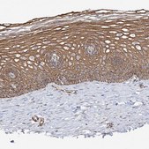 Anti-DCDC2 antibody produced in rabbit Prestige Antibodies&#174; Powered by Atlas Antibodies, affinity isolated antibody, buffered aqueous glycerol solution