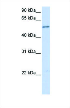 Anti-IL1RL1 antibody produced in rabbit affinity isolated antibody