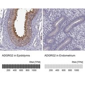 Anti-ADGRG2 antibody produced in rabbit Prestige Antibodies&#174; Powered by Atlas Antibodies, affinity isolated antibody, buffered aqueous glycerol solution