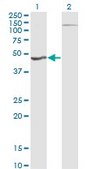 Monoclonal Anti-HGD antibody produced in mouse clone 1F1, purified immunoglobulin, buffered aqueous solution