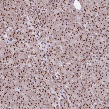 Anti-RIPK3 antibody produced in rabbit Prestige Antibodies&#174; Powered by Atlas Antibodies, affinity isolated antibody, buffered aqueous glycerol solution