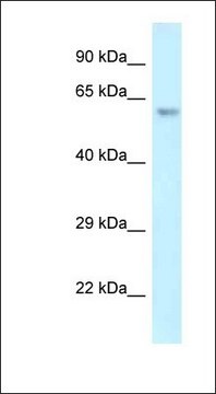 Anti-ERG antibody produced in rabbit affinity isolated antibody