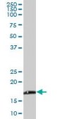 Anti-NDUFB6 antibody produced in mouse IgG fraction of antiserum, buffered aqueous solution