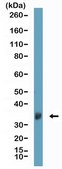 Anti-Clusterin Rabbit Monoclonal Antibody clone RM437, affinity purified immunoglobulin