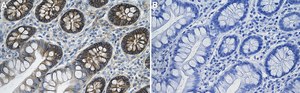 Anti-CD167a/DDR1 Antibody, clone 1D11 ZooMAb&#174; Rabbit Monoclonal recombinant, expressed in HEK 293 cells