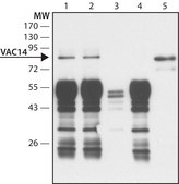 Anti-VAC14 antibody produced in rabbit ~1.5&#160;mg/mL, affinity isolated antibody, buffered aqueous solution