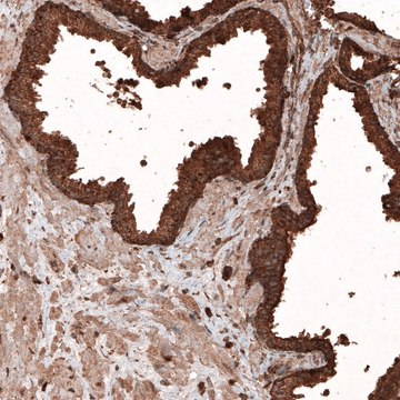 Monoclonal Anti-LAMP1 antibody produced in mouse Prestige Antibodies&#174; Powered by Atlas Antibodies, clone CL4463, purified immunoglobulin