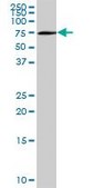 Anti-OPTN antibody produced in mouse purified immunoglobulin, buffered aqueous solution