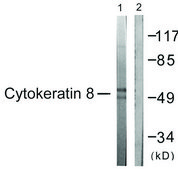 Anti-Keratin 8 antibody produced in rabbit affinity isolated antibody