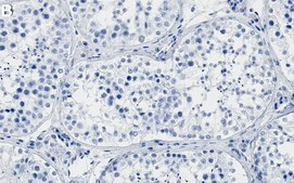 Anti-Ataxin-3 Antibody, clone 2C14 ZooMAb&#174; Rabbit Monoclonal recombinant, expressed in HEK 293 cells
