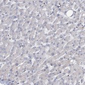 Anti-LRCH4 antibody produced in rabbit Prestige Antibodies&#174; Powered by Atlas Antibodies, affinity isolated antibody, buffered aqueous glycerol solution