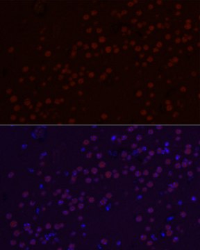 Anti-SATB2 Antibody, clone 3F9E1, Rabbit Monoclonal
