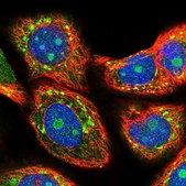 Anti-MIF4GD antibody produced in rabbit Prestige Antibodies&#174; Powered by Atlas Antibodies, affinity isolated antibody, buffered aqueous glycerol solution