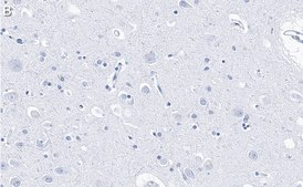 Anti-PSD-95 Antibody, clone 2B20 ZooMAb&#174; Rabbit Monoclonal recombinant, expressed in HEK 293 cells