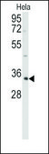 Anti-CSNK1A1L (N-term) antibody produced in rabbit saturated ammonium sulfate (SAS) precipitated, buffered aqueous solution