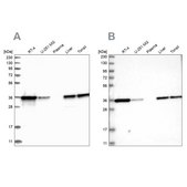 Anti-PDXK antibody produced in rabbit Prestige Antibodies&#174; Powered by Atlas Antibodies, affinity isolated antibody, buffered aqueous glycerol solution