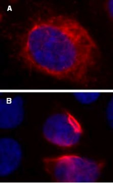 LentiBrite RFP-Vimentin Lentiviral Biosensor