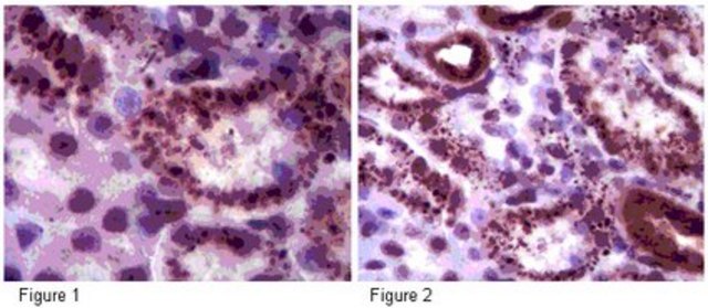 Anti-Sirt5 Antibody from rabbit, purified by affinity chromatography
