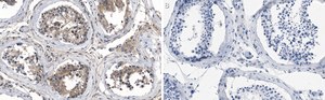 Anti-VE-Cadherin Antibody, clone 1O12 ZooMAb&#174; Rabbit Monoclonal recombinant, expressed in HEK 293 cells