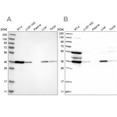 Anti-TP53I3 antibody produced in rabbit Prestige Antibodies&#174; Powered by Atlas Antibodies, affinity isolated antibody, buffered aqueous glycerol solution