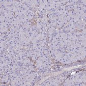 Anti-ABCA8 antibody produced in rabbit Prestige Antibodies&#174; Powered by Atlas Antibodies, affinity isolated antibody, buffered aqueous glycerol solution