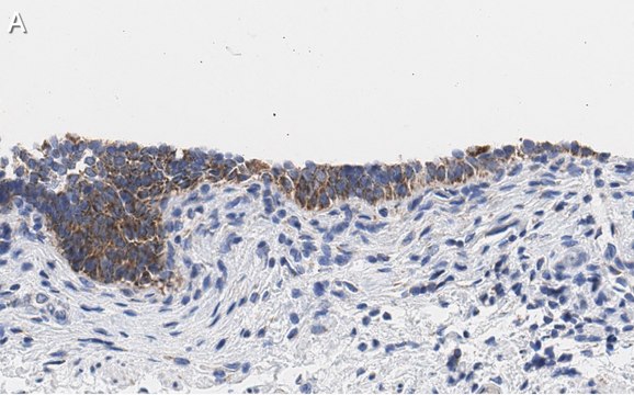 Anti-TMEM261 Antibody, clone 2C22 ZooMAb&#174; Rabbit Monoclonal recombinant, expressed in HEK 293 cells