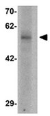 Anti-BMP Antibody15 from rabbit, purified by affinity chromatography