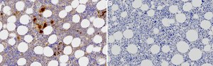 Anti-TGF-β1 Antibody, clone 4E3 ZooMAb&#174; Rabbit Monoclonal recombinant, expressed in HEK 293 cells