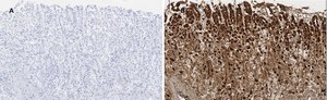 Anti-ALDH1A1 Antibody, clone 4J6, ZooMAb&#174; Rabbit Monoclonal recombinant, expressed in HEK 293 cells