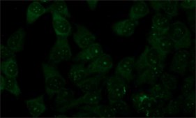 Anti-SUMO-2 antibody produced in rabbit ~0.6&#160;mg/mL, affinity isolated antibody, buffered aqueous solution