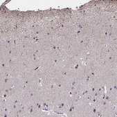 Anti-CACNG8 antibody produced in rabbit Prestige Antibodies&#174; Powered by Atlas Antibodies, affinity isolated antibody, buffered aqueous glycerol solution
