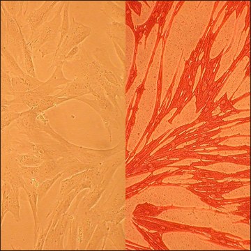 Canine Pulmonary Artery Smooth Muscle Cells: CnPASMC (Cryovial)