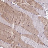Anti-MYL2 antibody produced in rabbit Prestige Antibodies&#174; Powered by Atlas Antibodies, affinity isolated antibody, buffered aqueous glycerol solution